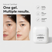 Mediskin - Advanced, Deep hydrating, Glass skin All in one cream