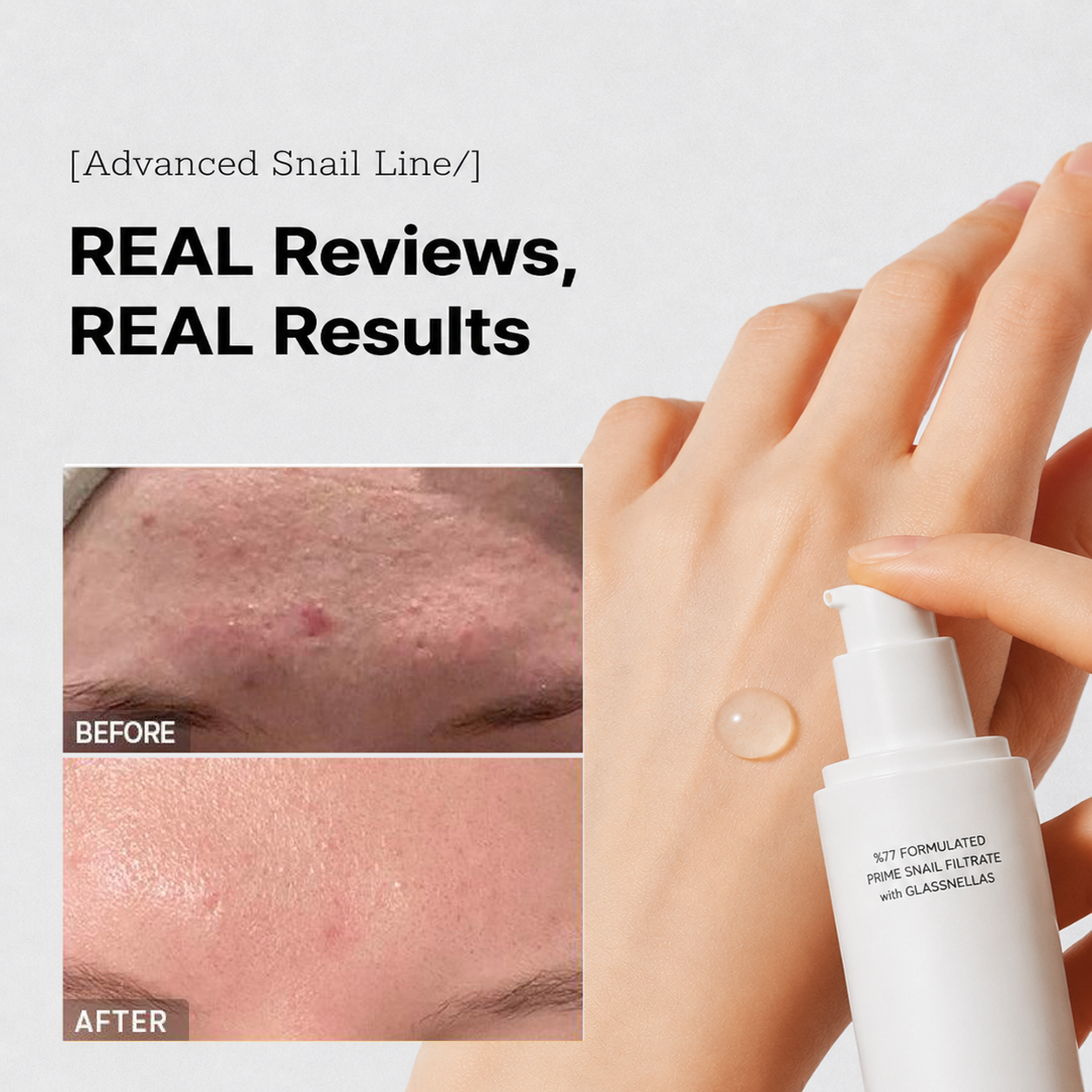 UNLOCK PRO SNAIL FILTRATÉ - FILLER SERUM